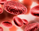 Schematische Darstellung einer Sepsis im Blutbild